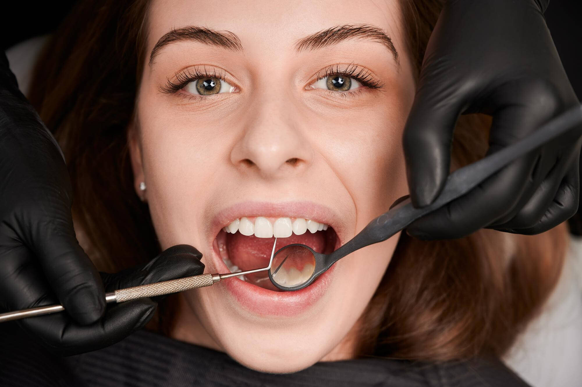 Content-09 $variable({"type":"content","value":{"name":"site_title","settings":{"before":"Achieve your best smile at ","after":""}}})$