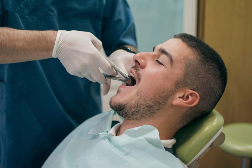 Wisdom Tooth Extraction
