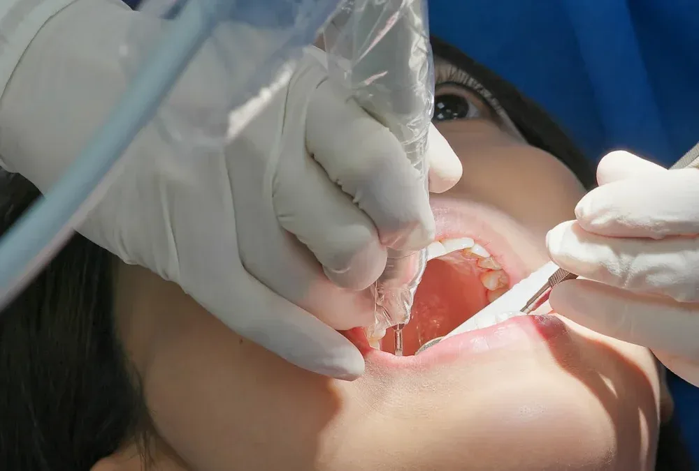 Root Canal Therapy