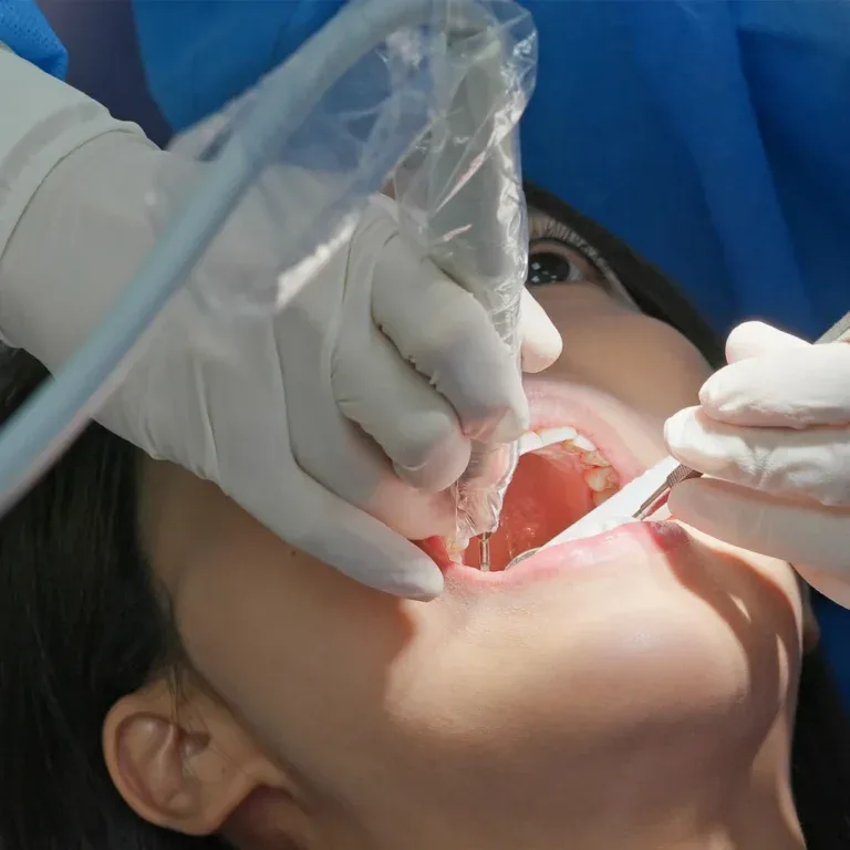 Root Canal Therapy