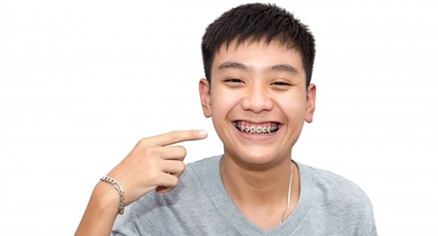 Benefits of Straight Teeth