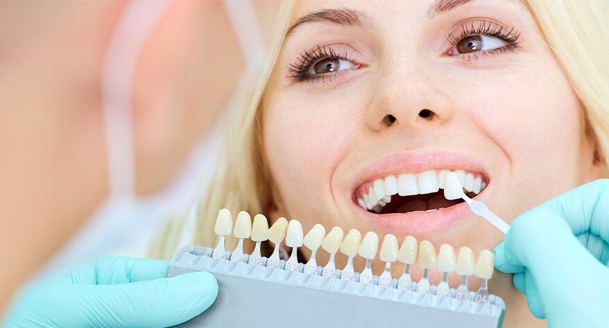 Porcelain Veneers
