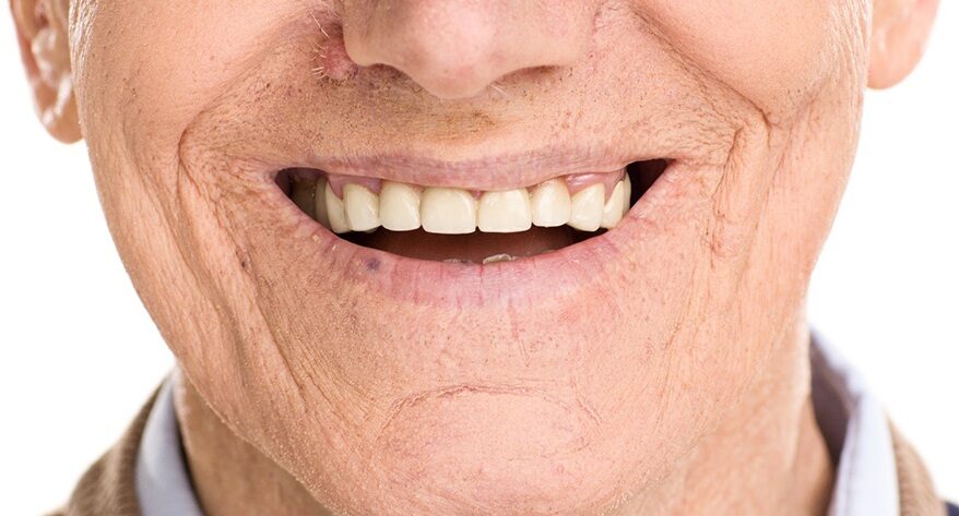 Benefits of Dentures