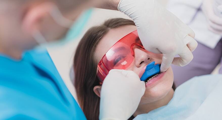 Dental Sealants and Fluoride Treatment
