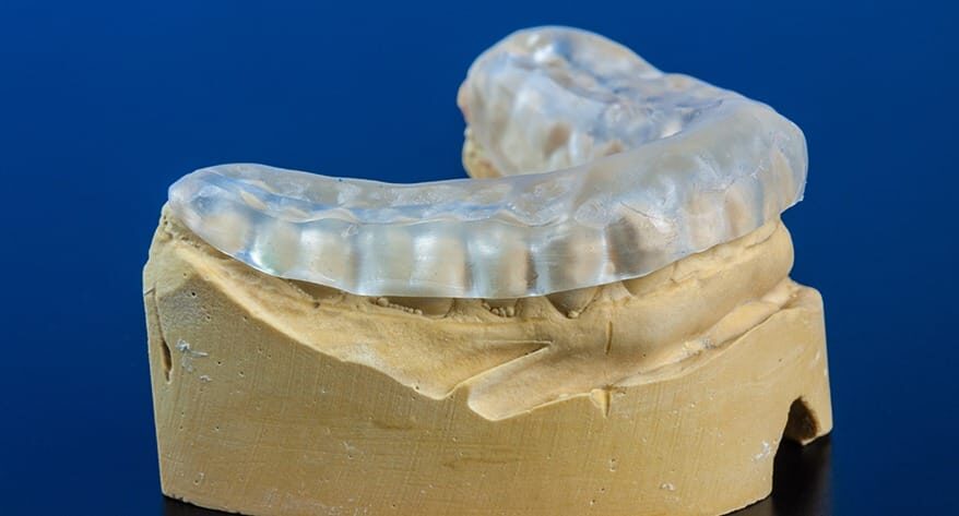 Occlusal Splints for TMJ